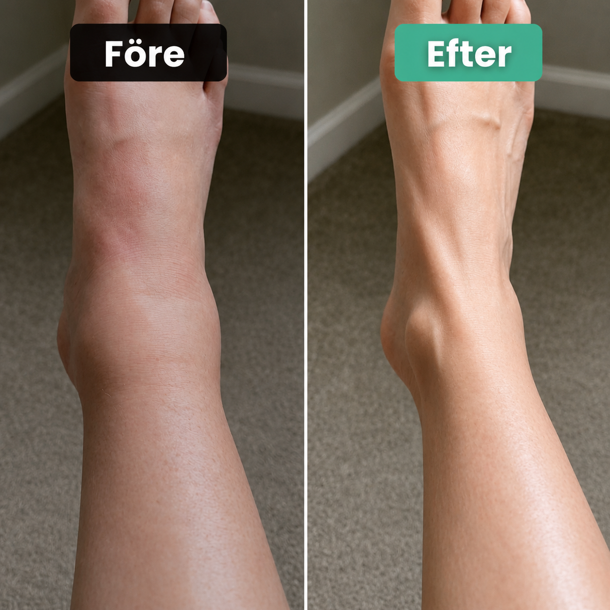 FeetCare Pro™ | Djupmassagebehandling