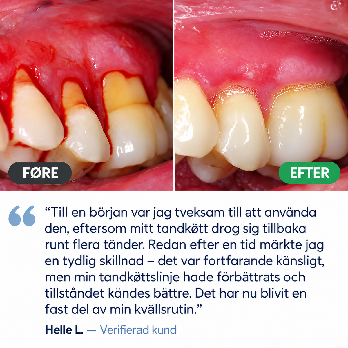 TandRo™ | Gel för daglig tandköttsvård