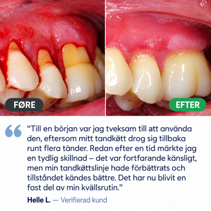 TandRo™ | Gel för daglig tandköttsvård