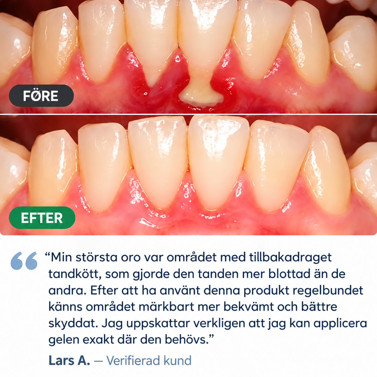 TandRo™ | Gel för daglig tandköttsvård