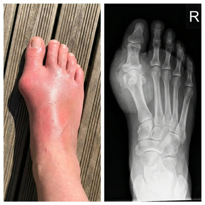ArthroFix™ | Kapslar för daglig ledvård